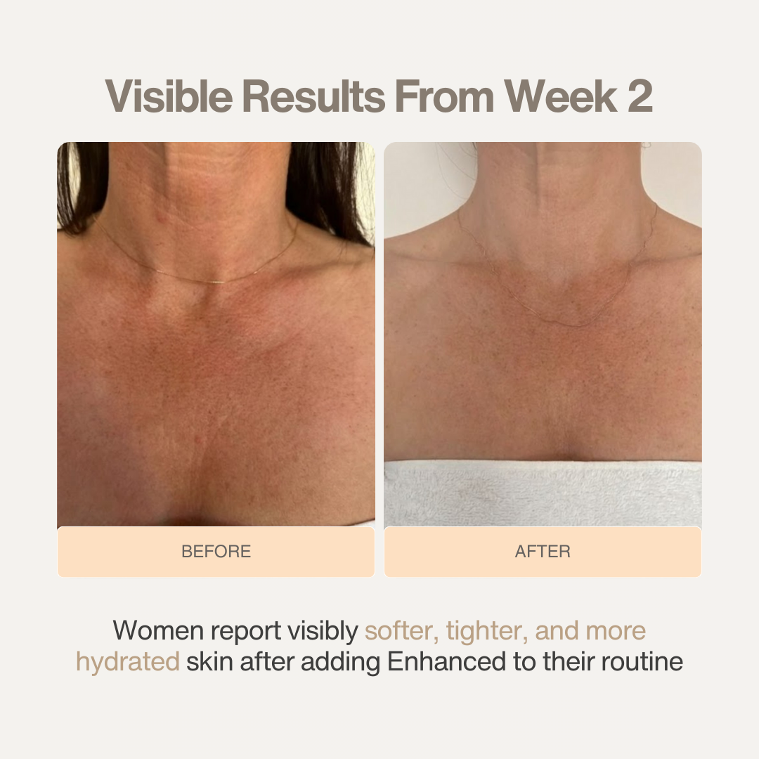 Enhanced Cellulite Massage Oil